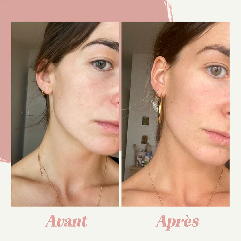 Crème Visage Autobronzante